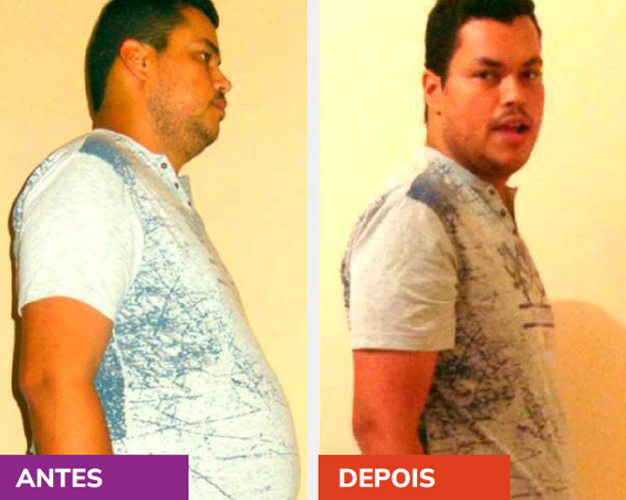 Kit Emagreslim Rapid Resultados